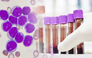 Toxicology Tx
